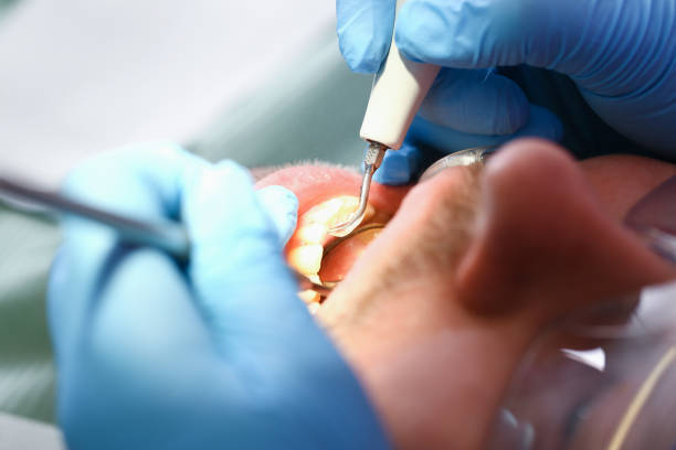 Best Emergency Broken Tooth Repair in Fords, NJ